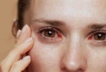 9 Nutrient Deficiency Signs Your Body May Show and What to Eat to Correct Them.